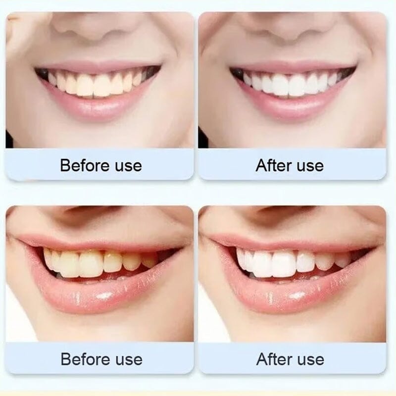 Super Probiotic-6 Toothpaste