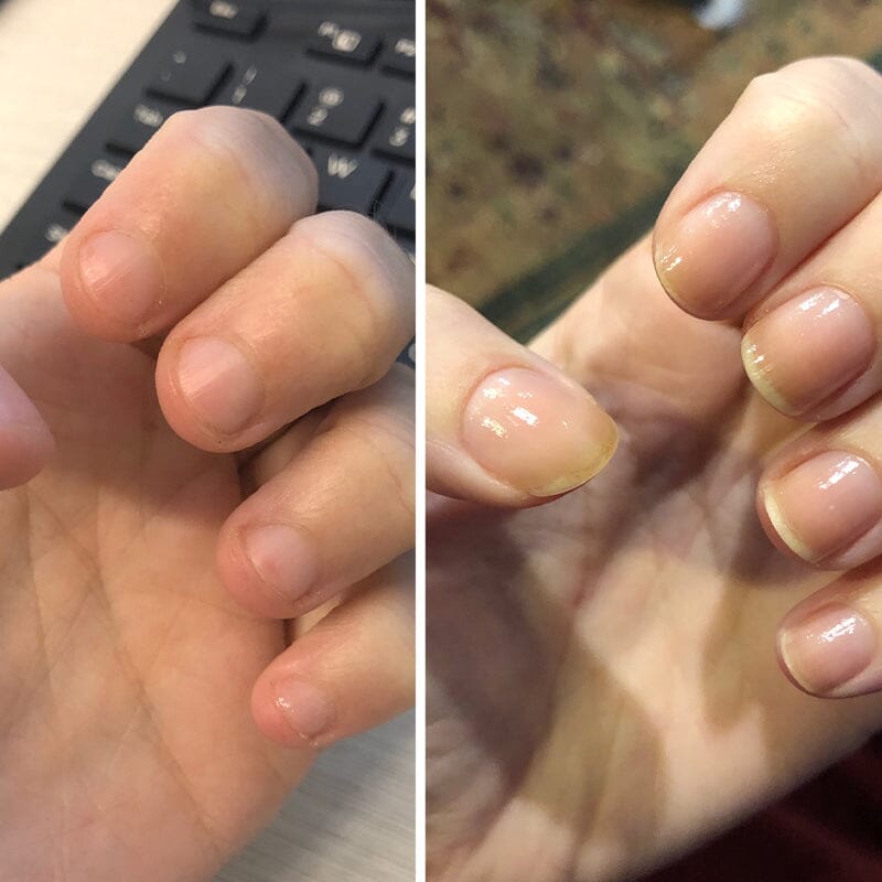 Ölstift für die Nagelernährung