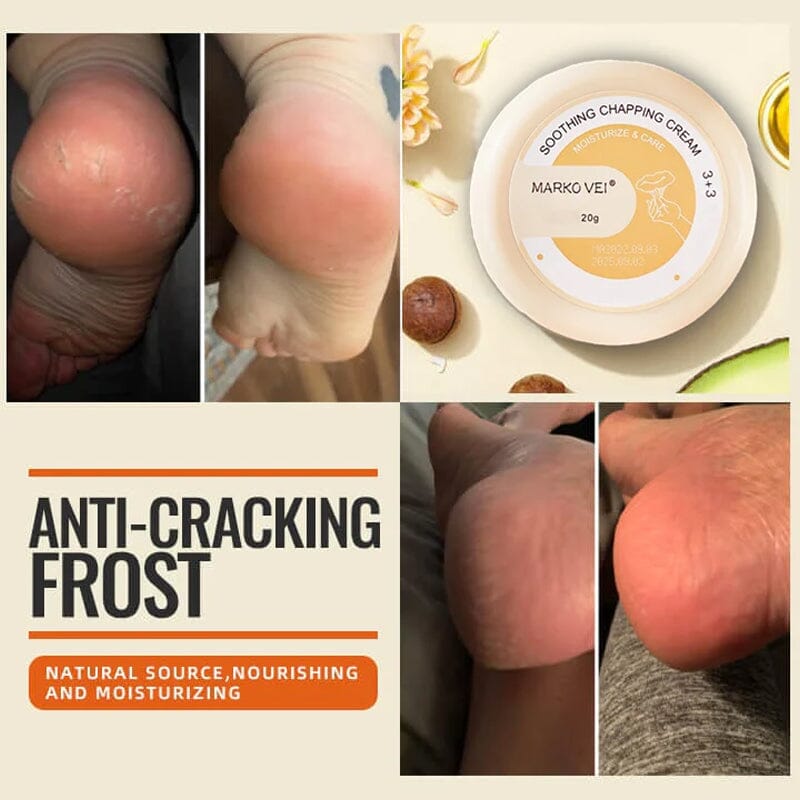 🎁SALE-50% OFF🎁Winter Anti-Cracking Frost