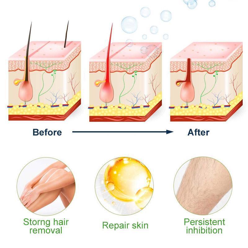 Semi-Permanent Hair Re-moval Spray