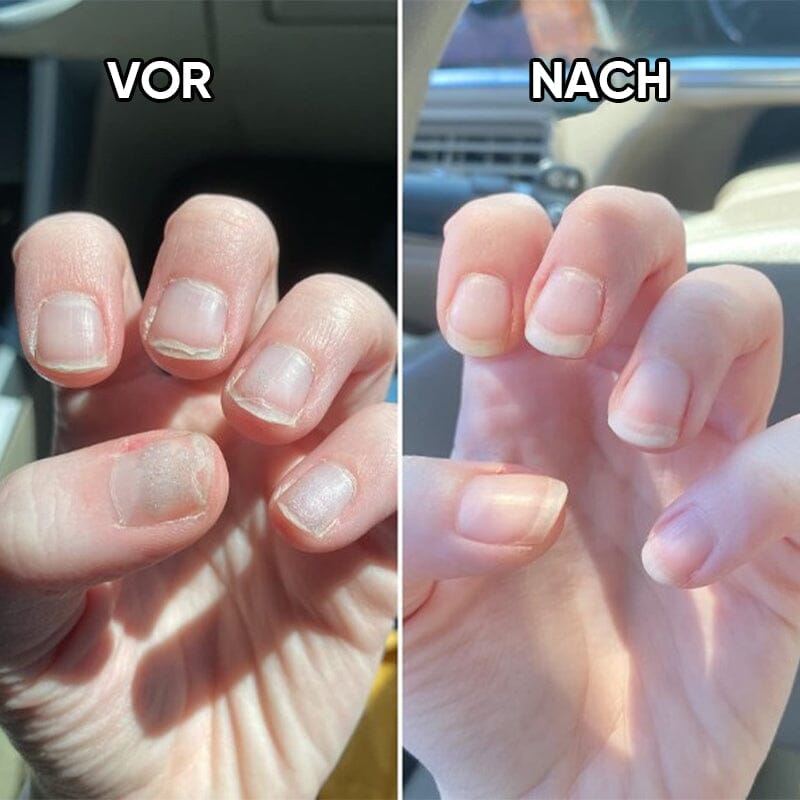 Ölstift für die Nagelernährung
